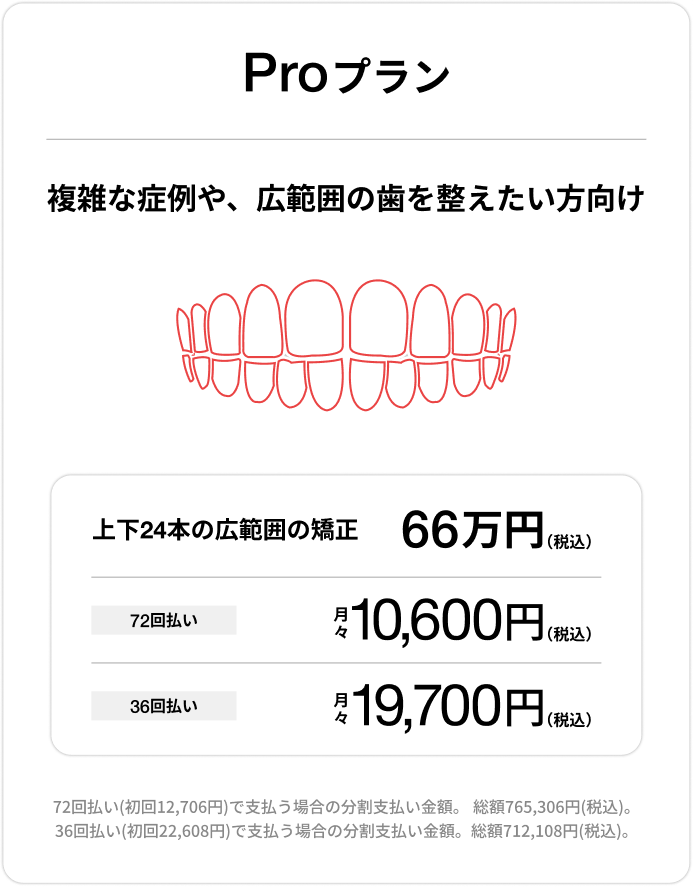 Proプラン、上下前歯24本の部分矯正66万円（税込）、72回払い 月々10,600円（税込）、36回払い 月々19,700円（税込）