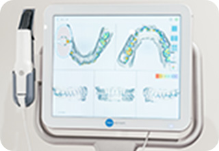 歯型3Dスキャン