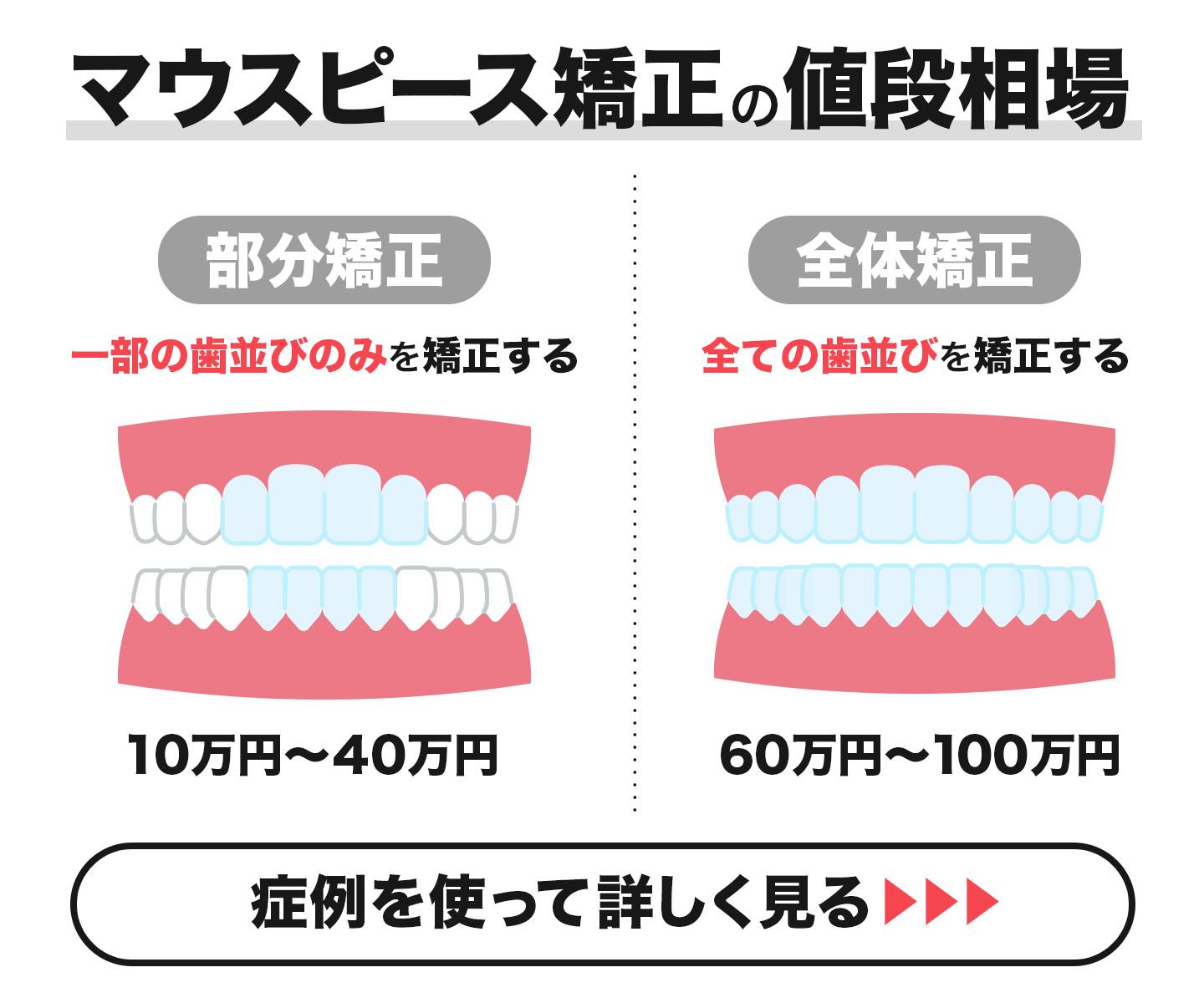 マウスピース矯正の費用相場
