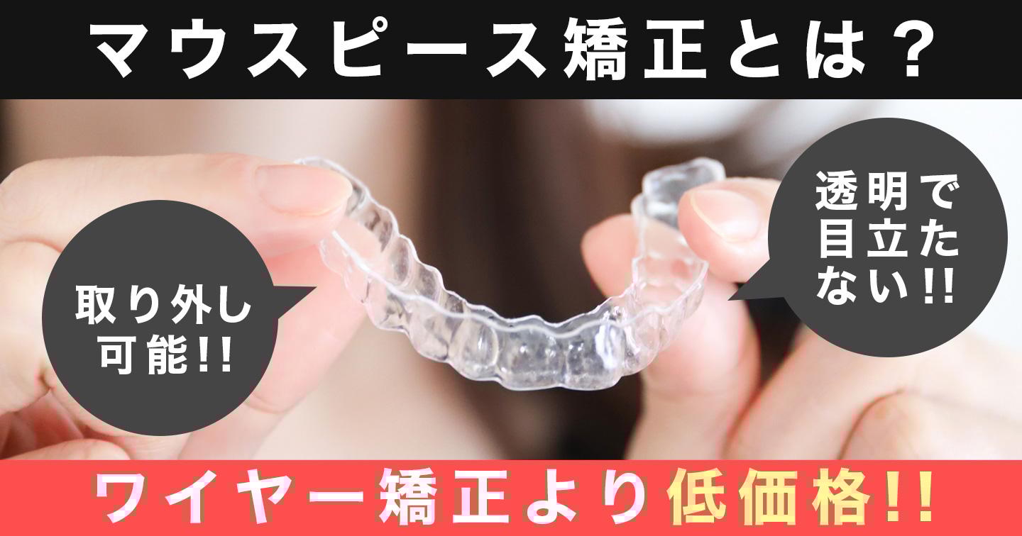 マウスピース矯正とは