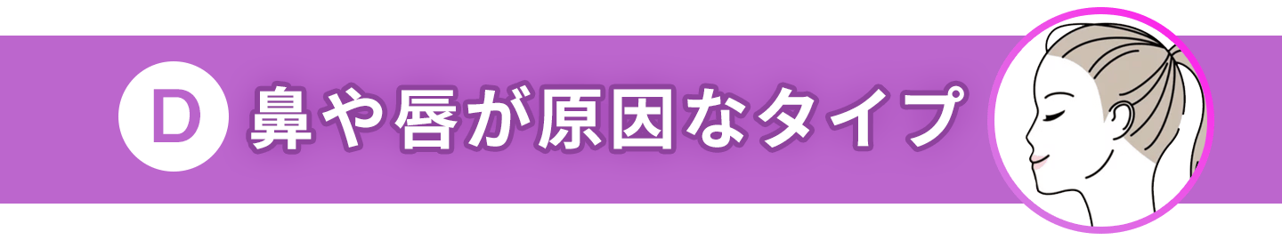 Dタイプバナー