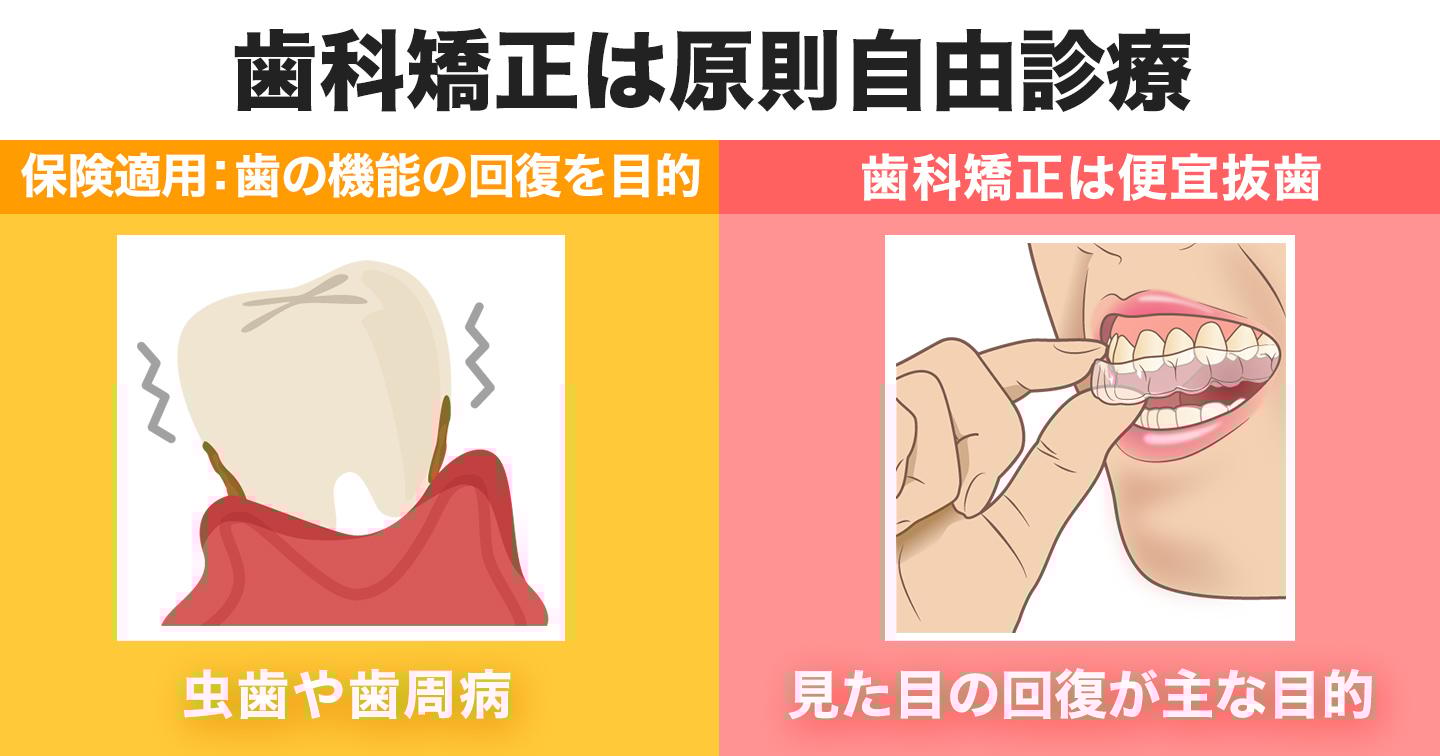 歯科矯正は原則自由診療