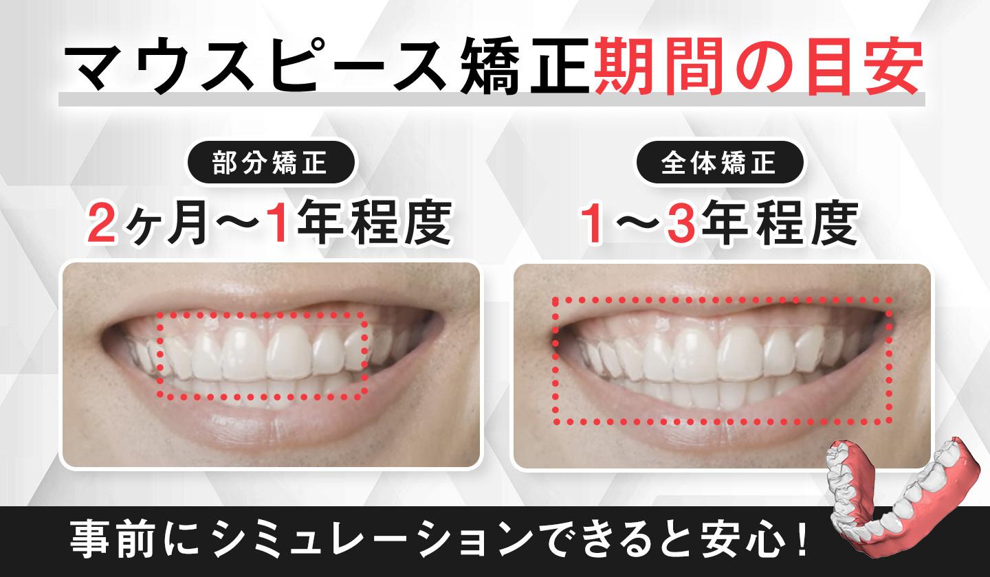マウスピース矯正の期間の目安