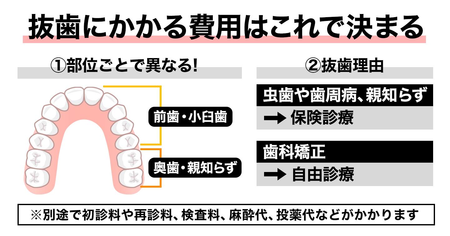 抜歯にかかる費用はこれ