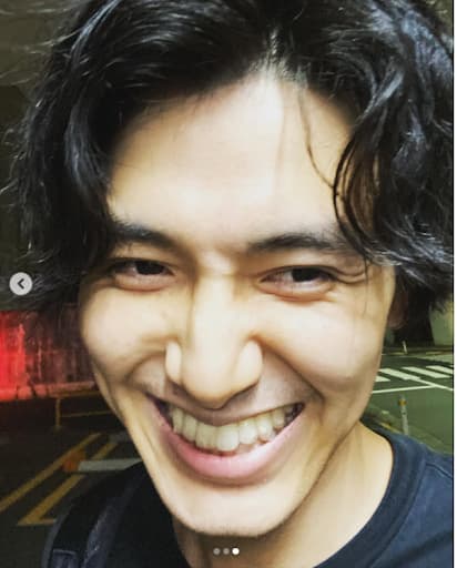 藤井風インビザライン画像２