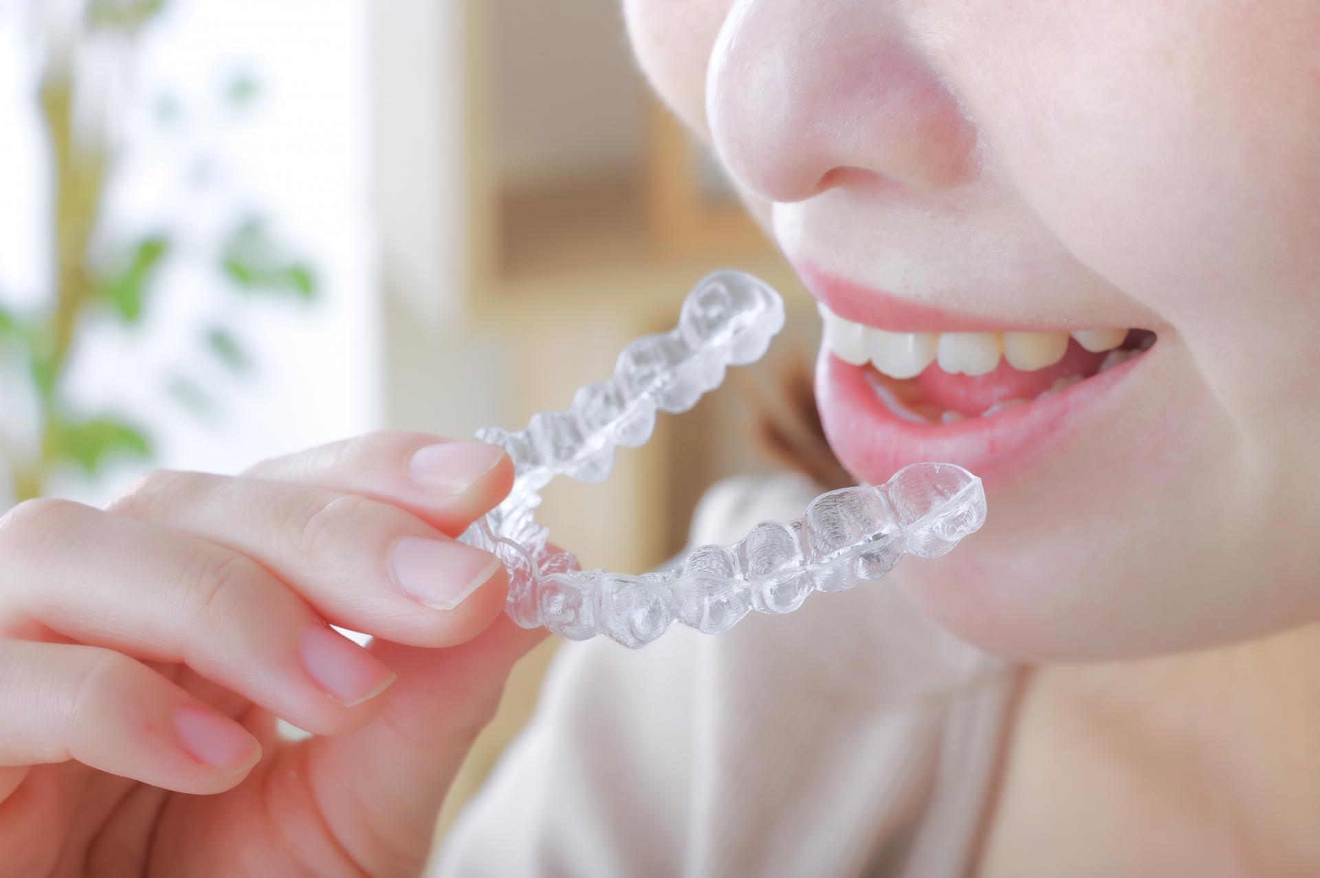 矯正中に器具や歯に着色を起こす3つの原因!予防法や対策も解説