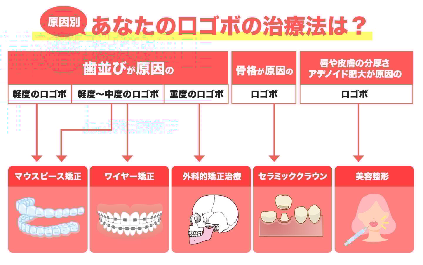 ロゴボCR2