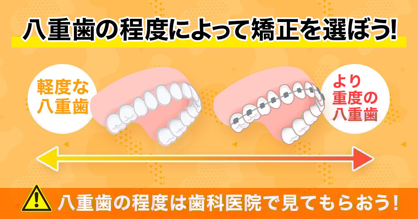 八重歯の程度によって治療方法は異なる