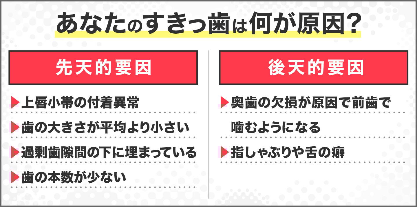 あなたのすきっ歯は何が原因?
