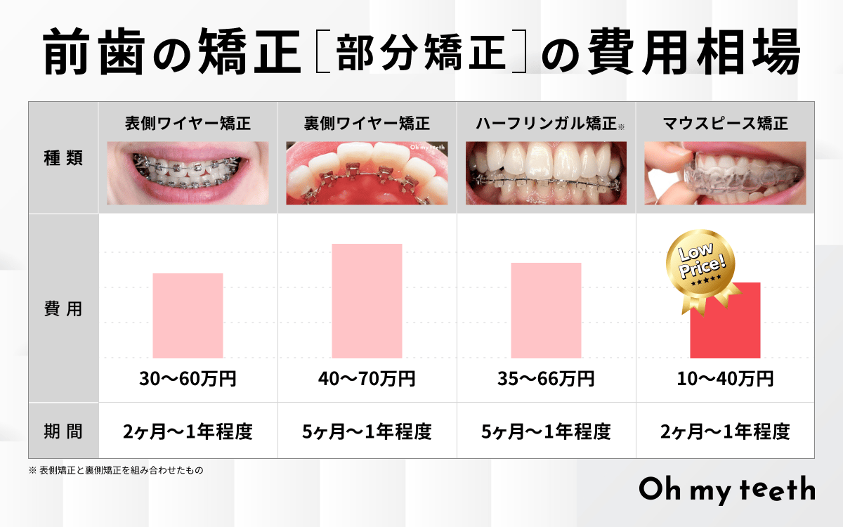 前歯だけ矯正の費用・期間はどのくらい?