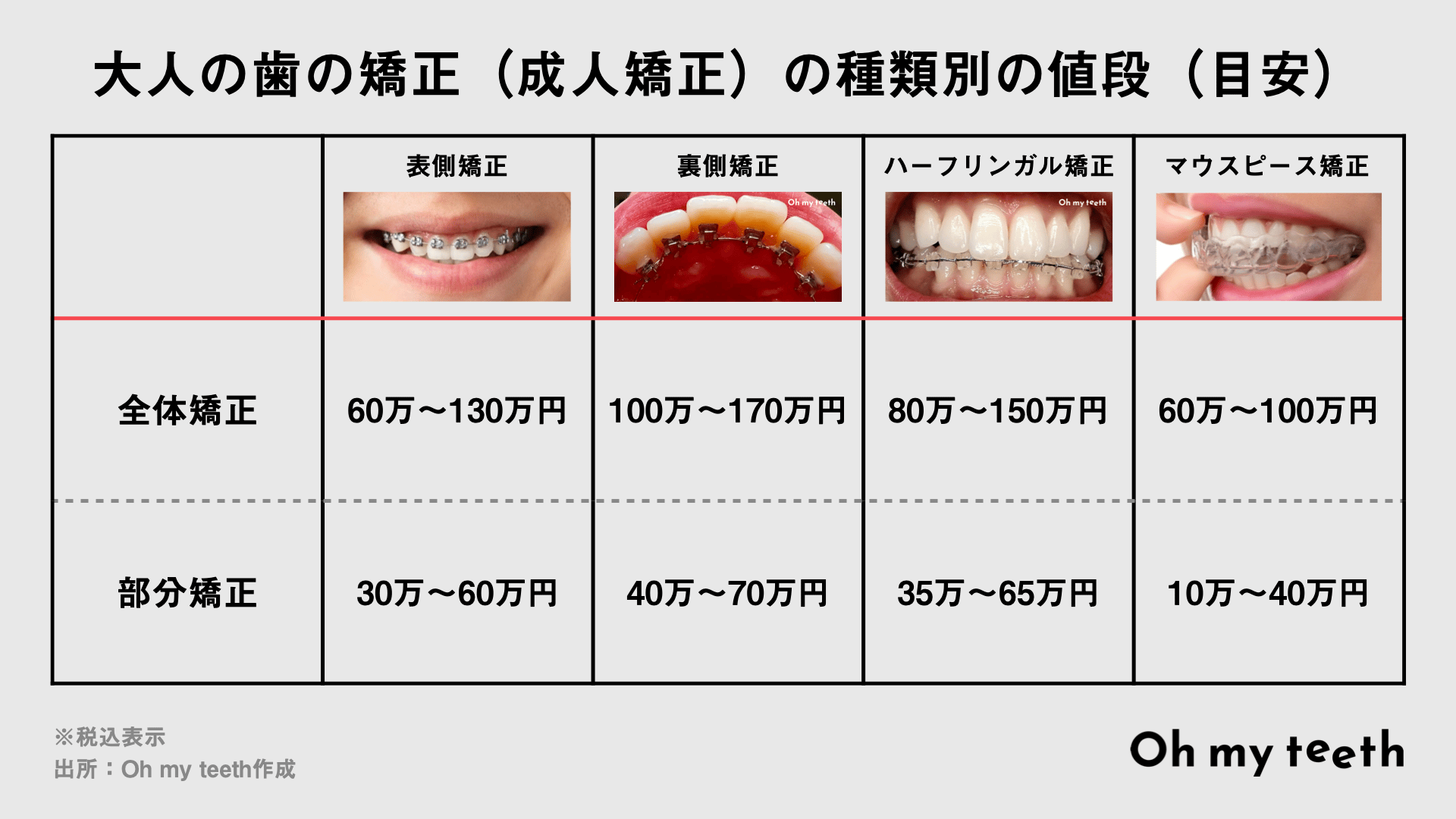 歯科矯正の種類別の
