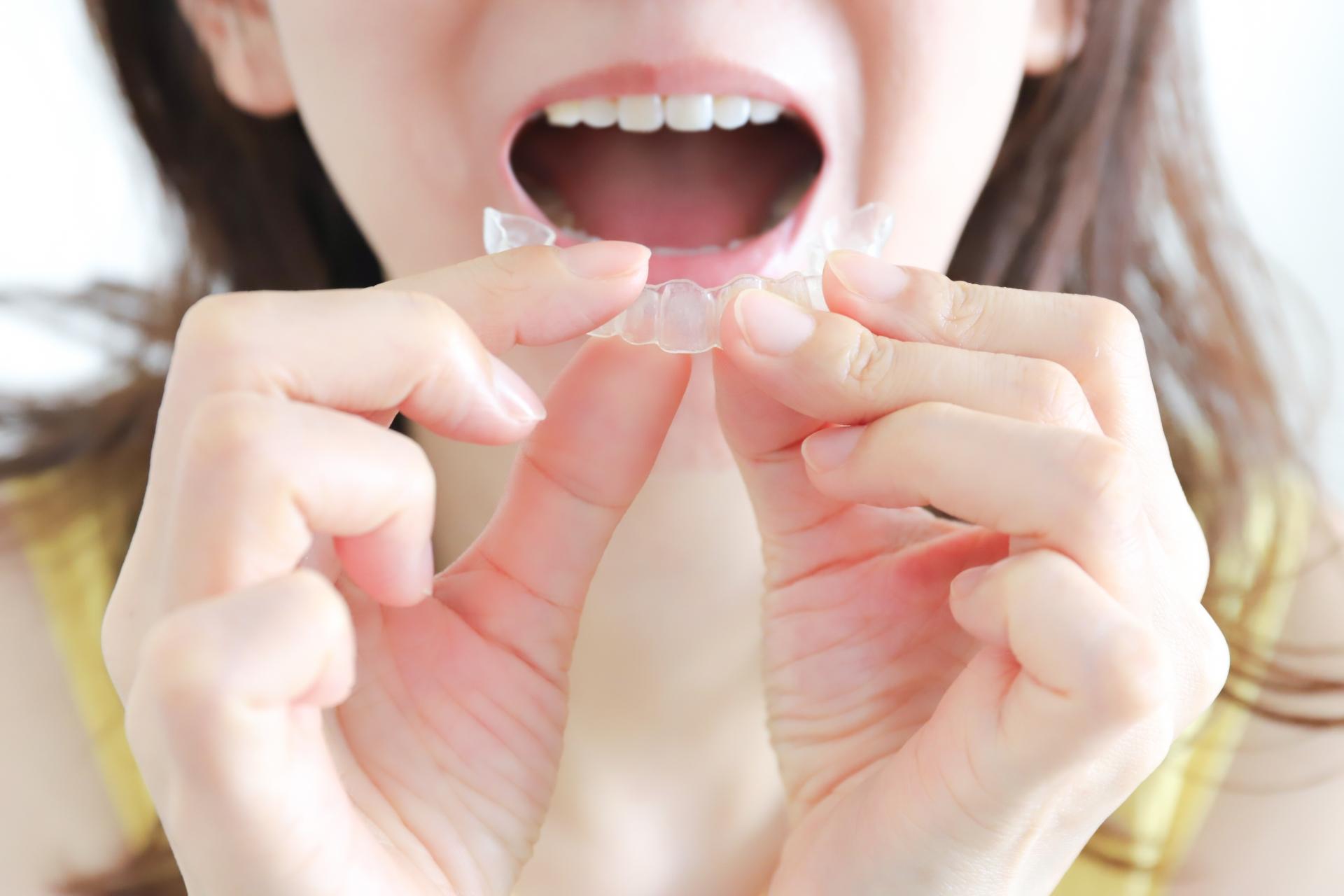 キレイラインとOh my teethの適応範囲は?