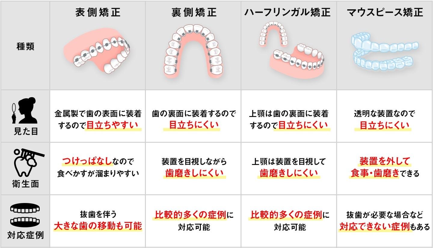 歯列矯正の種類別の特徴の違い:比較
