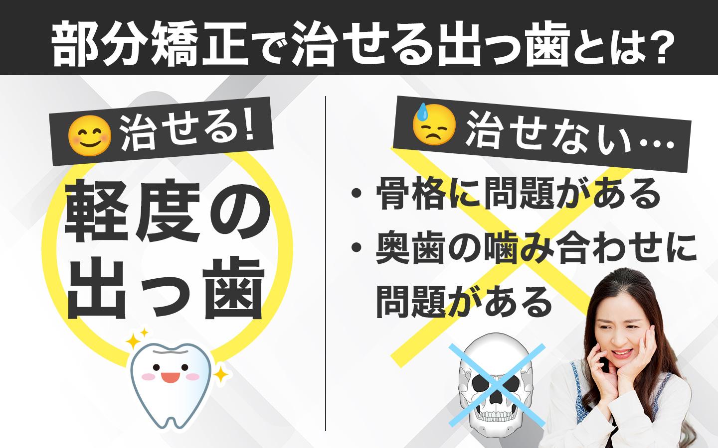 部分矯正で治せる出っ歯とは
