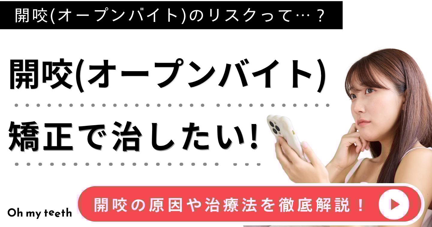 開咬アイキャッチ