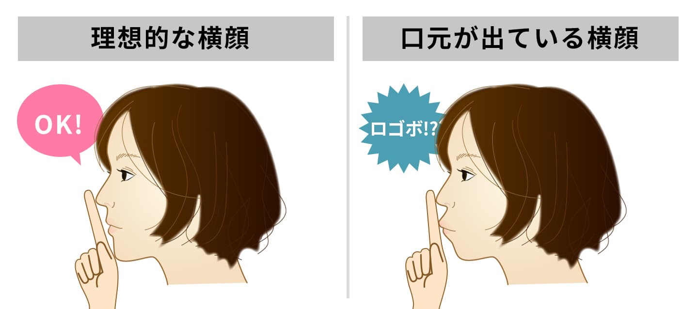ロゴボCR5