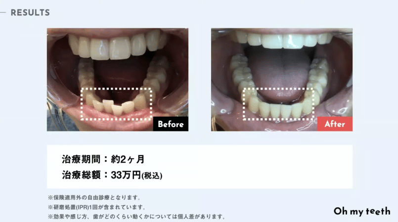 咀嚼不足で胃腸へ負担がかかる