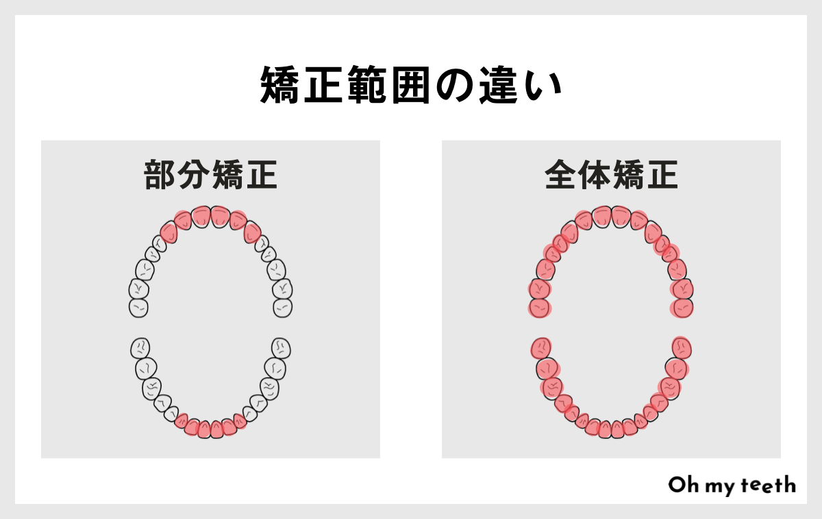 安いワイヤー矯正は大丈夫?低価格な理由や選ぶ際の注意点を解説