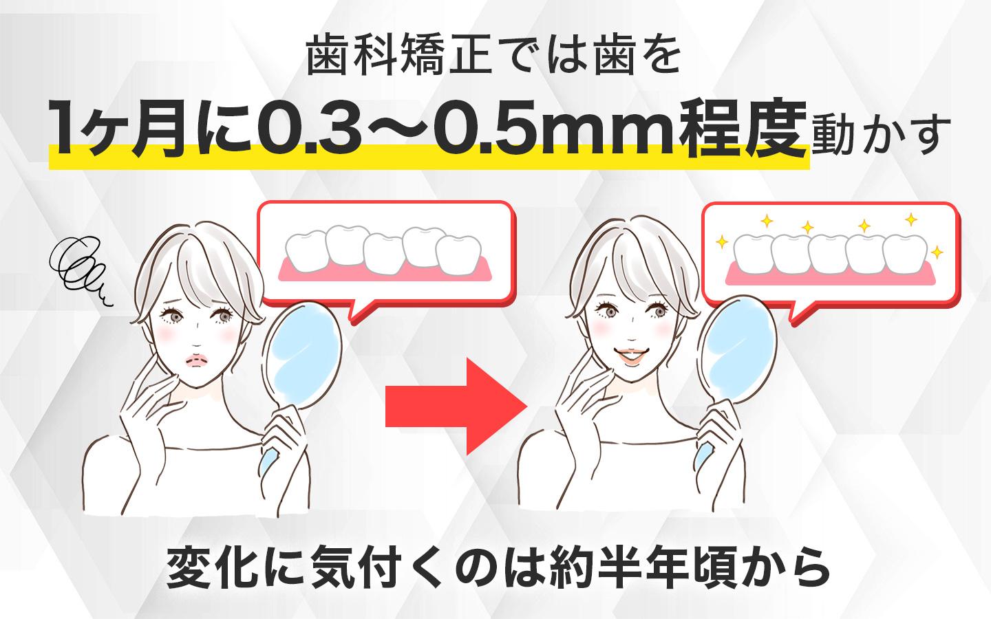 歯列矯正は1ヶ月で0.3~0.5mm程度歯が動く