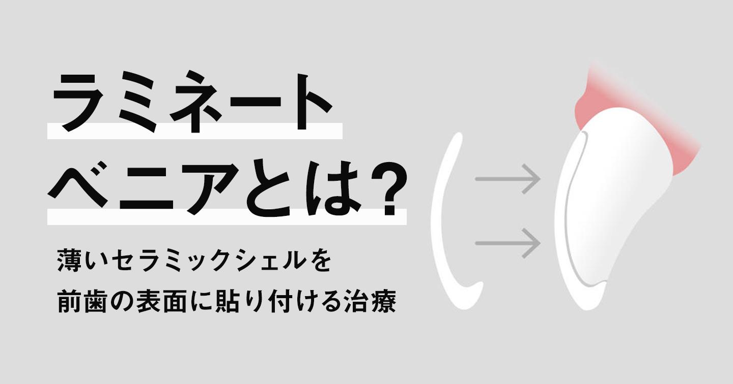 ラミネートベニアとは？