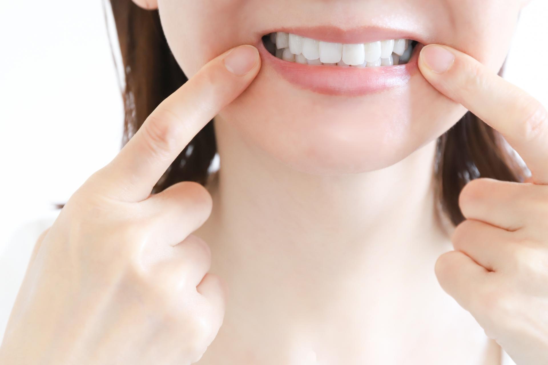 Oh my teethは「上の歯だけの矯正」に対応している?